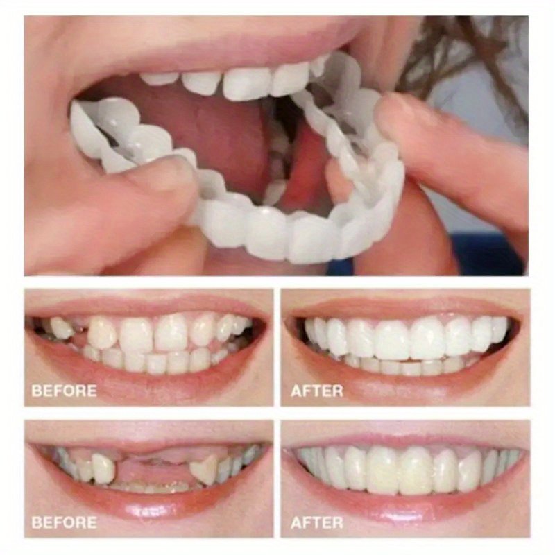 1728842686932-f56d415ffa4d46e59b081edfe3351cdc-goods.jpeg 4-Pack, Comfortable and Flexible White Dentures Veneer with Upper and Lower Alveolar Attachment, Easy to Wear, Unisex - Image 1