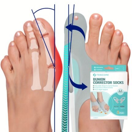 2pcs Corrector Sleeves with 4-Point Fixation